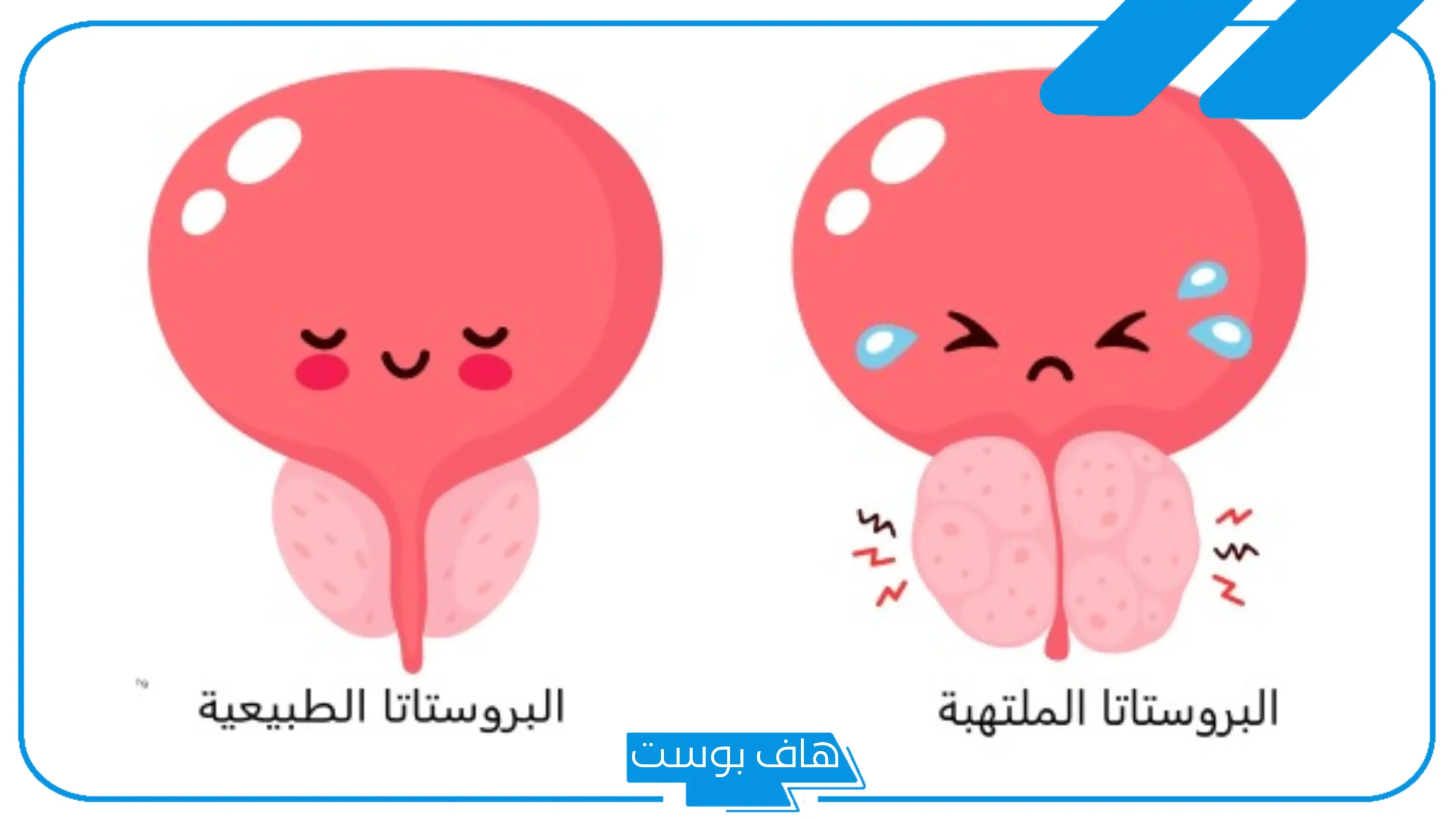تجربتي مع تدليك البروستاتا بالفوائد وكيفية عمل المساج