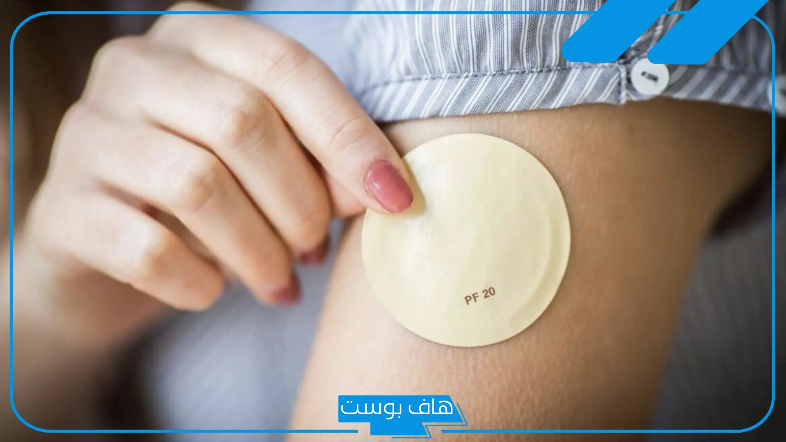 تجربتي مع لصقات منع الحمل بين الإيجابيات والسلبيات وطريقة الاستخدام