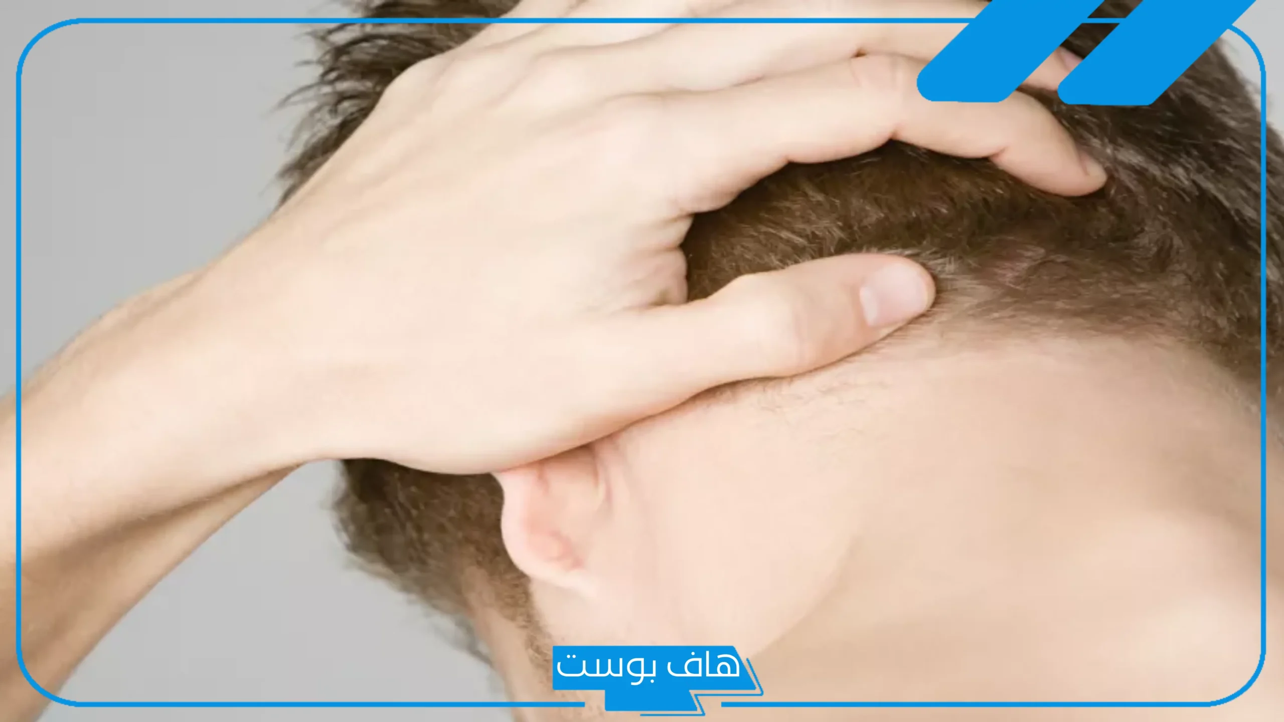 تجربتي مع تنسيم الراس بالأعراض والأسباب