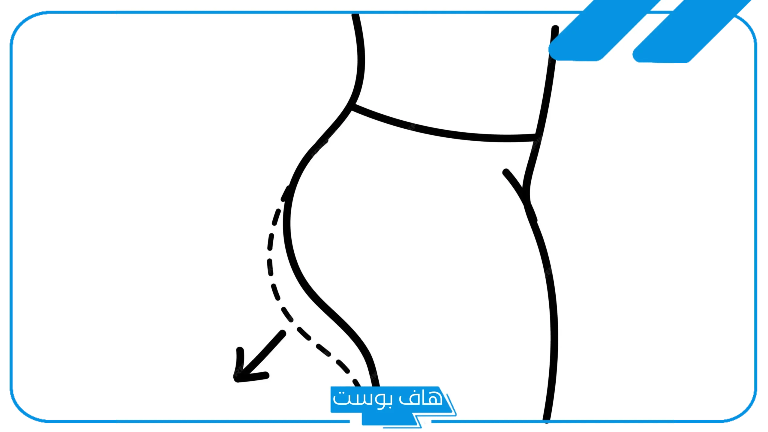 تجربتي الناجحه في تكبير المؤخره وشدها والعوامل المؤثرة في النتيجة