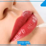 تجربتي مع توريد الشفايف بالليزر وأهم النصائح