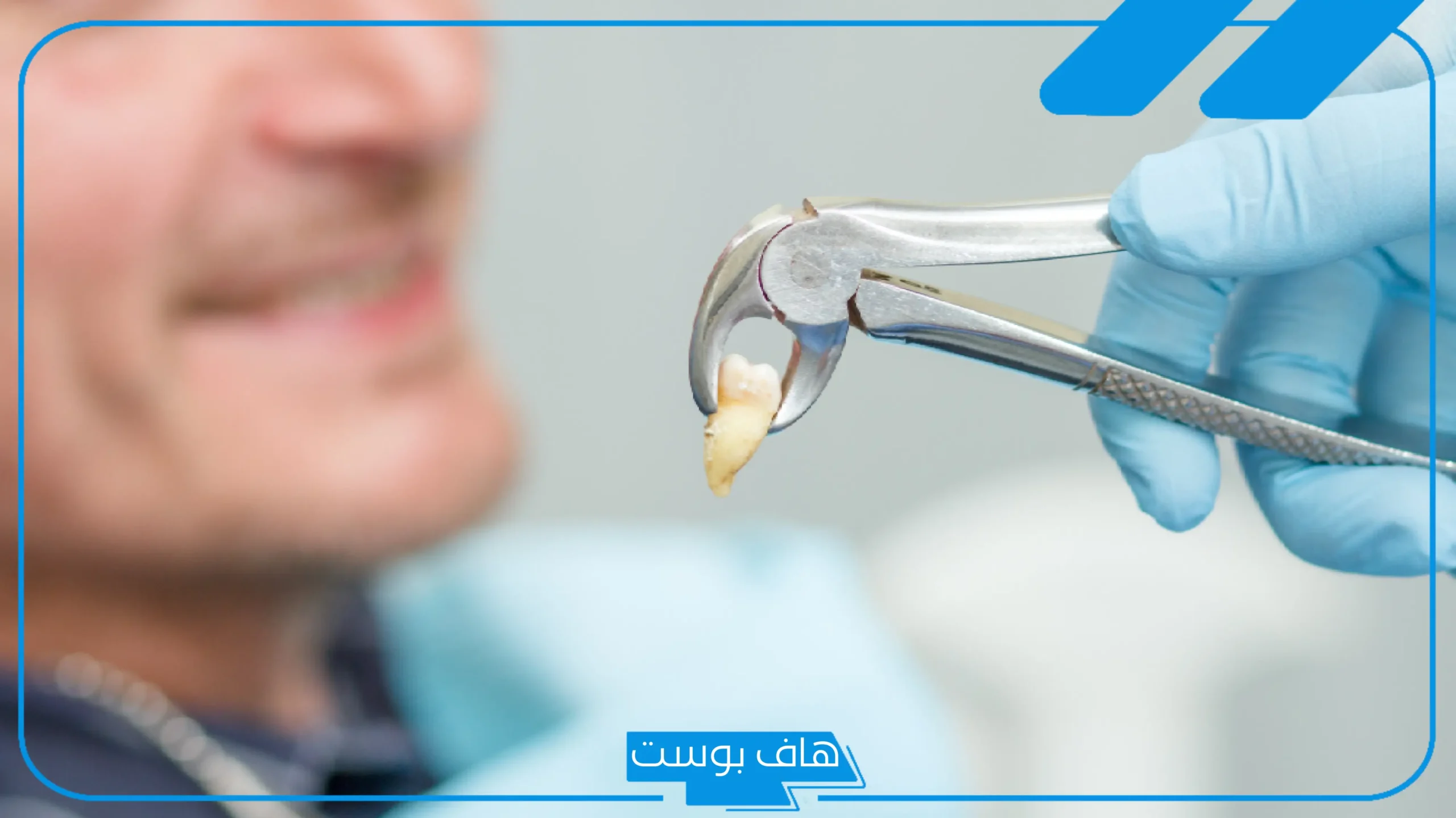 تفسير خلع الضرس في المنام دون أي ألم لكبار المفسرين للمتزوجة والعزباء