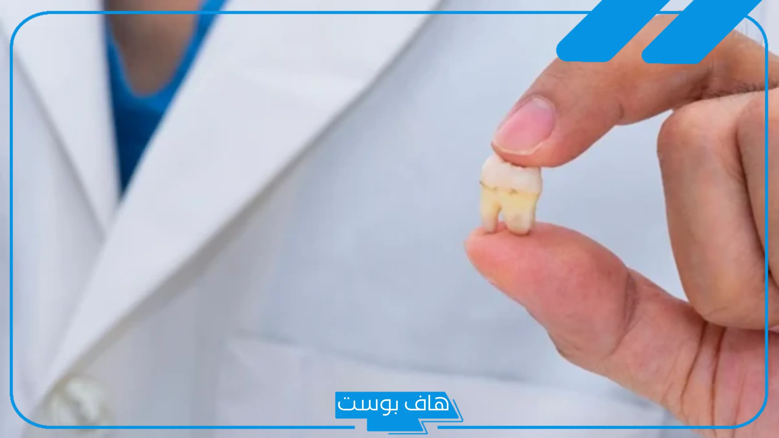 تفسير حلم خلع الضرس العلوي في المنام للرجل والمرأة العزباء والمتزوجة
