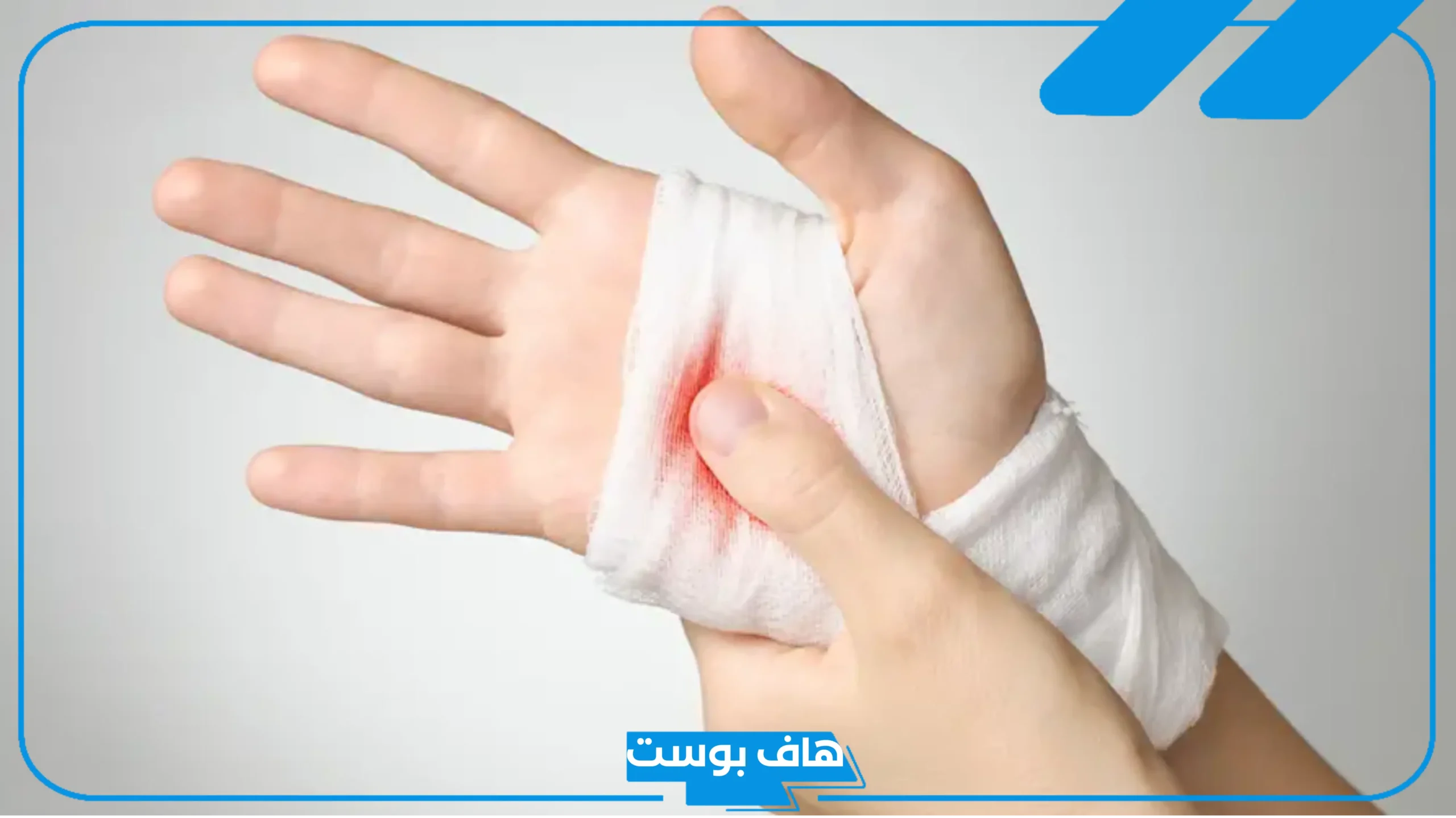 رؤية قطع اليد لشخص آخر في المنام لابن سيرين
