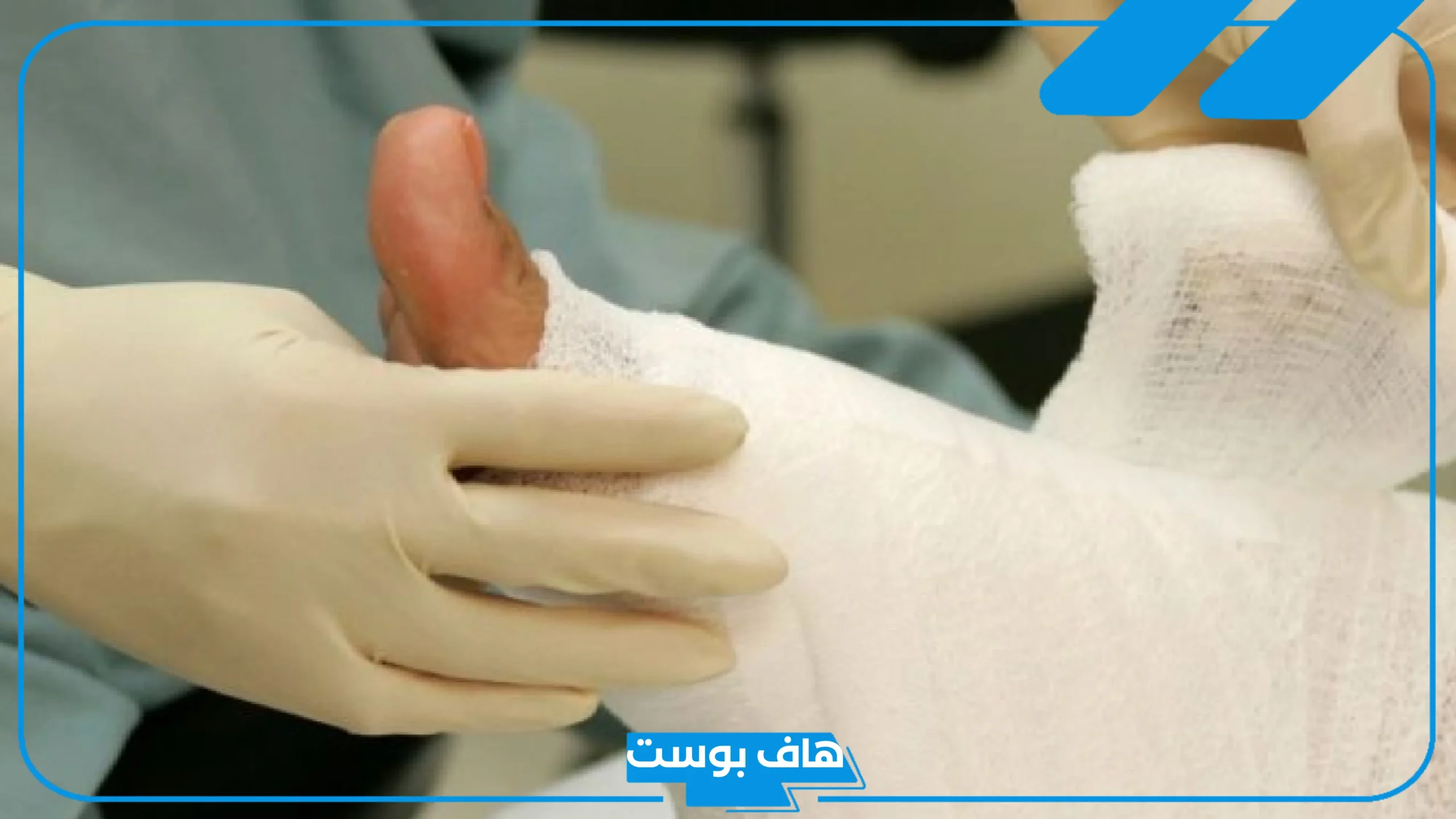 تفسير حلم الجرح في الرجل والإصابة ونزول الدم في المنام لابن سيرين