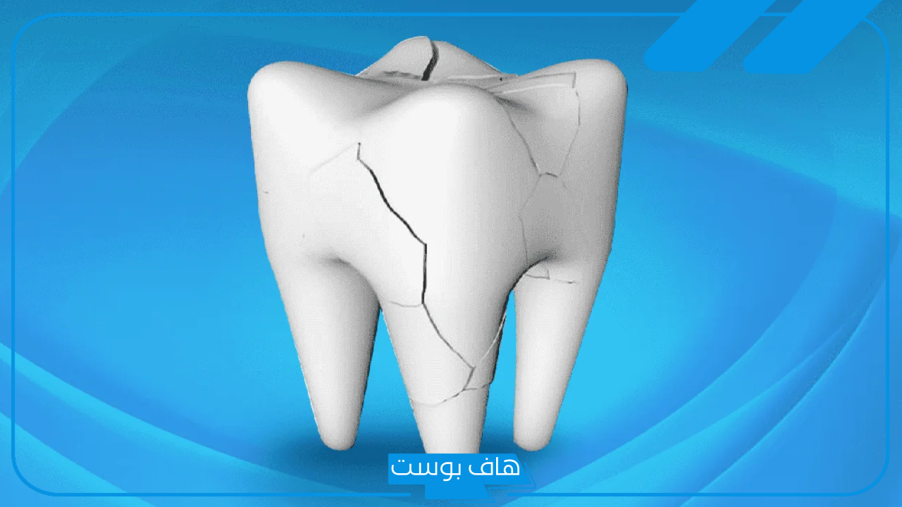 تفسير حلم كسر الضرس في المنام وخلعه لابن سيرين