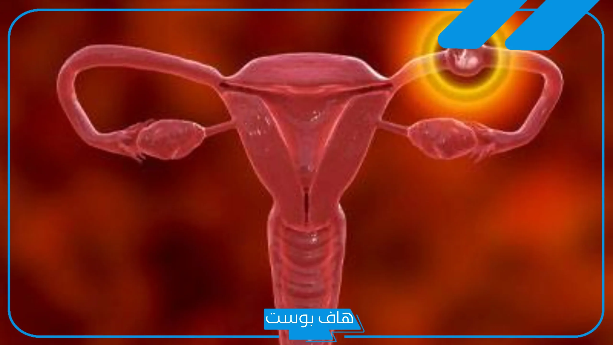 تجربتي مع الحمل خارج الرحم بالأسباب والأعراض