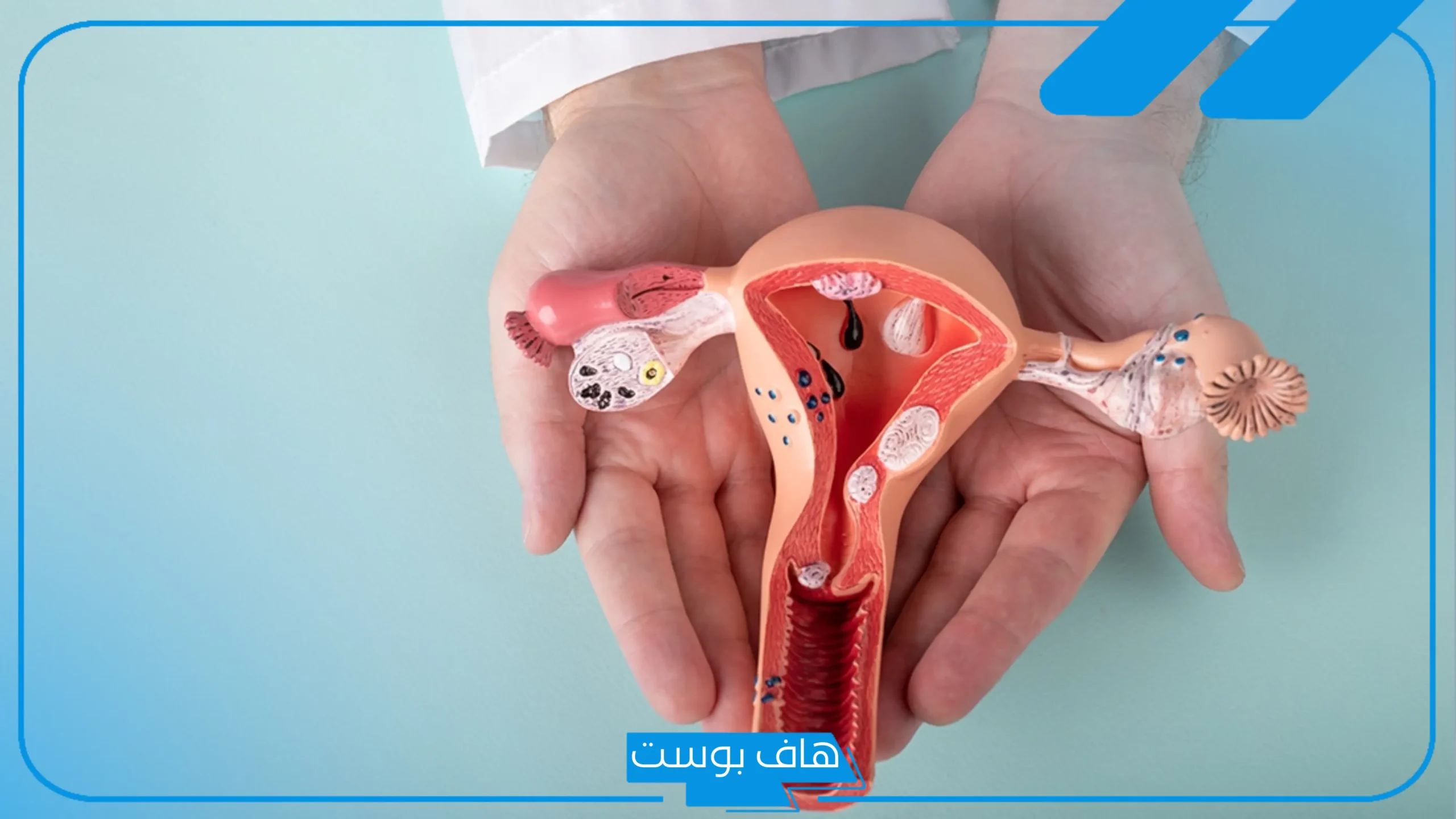 تجربتي مع عملية تضييق المهبل جراحيا بعد الولادة.. متى يمكن الجلوس بعد عملية تضييق المهبل؟