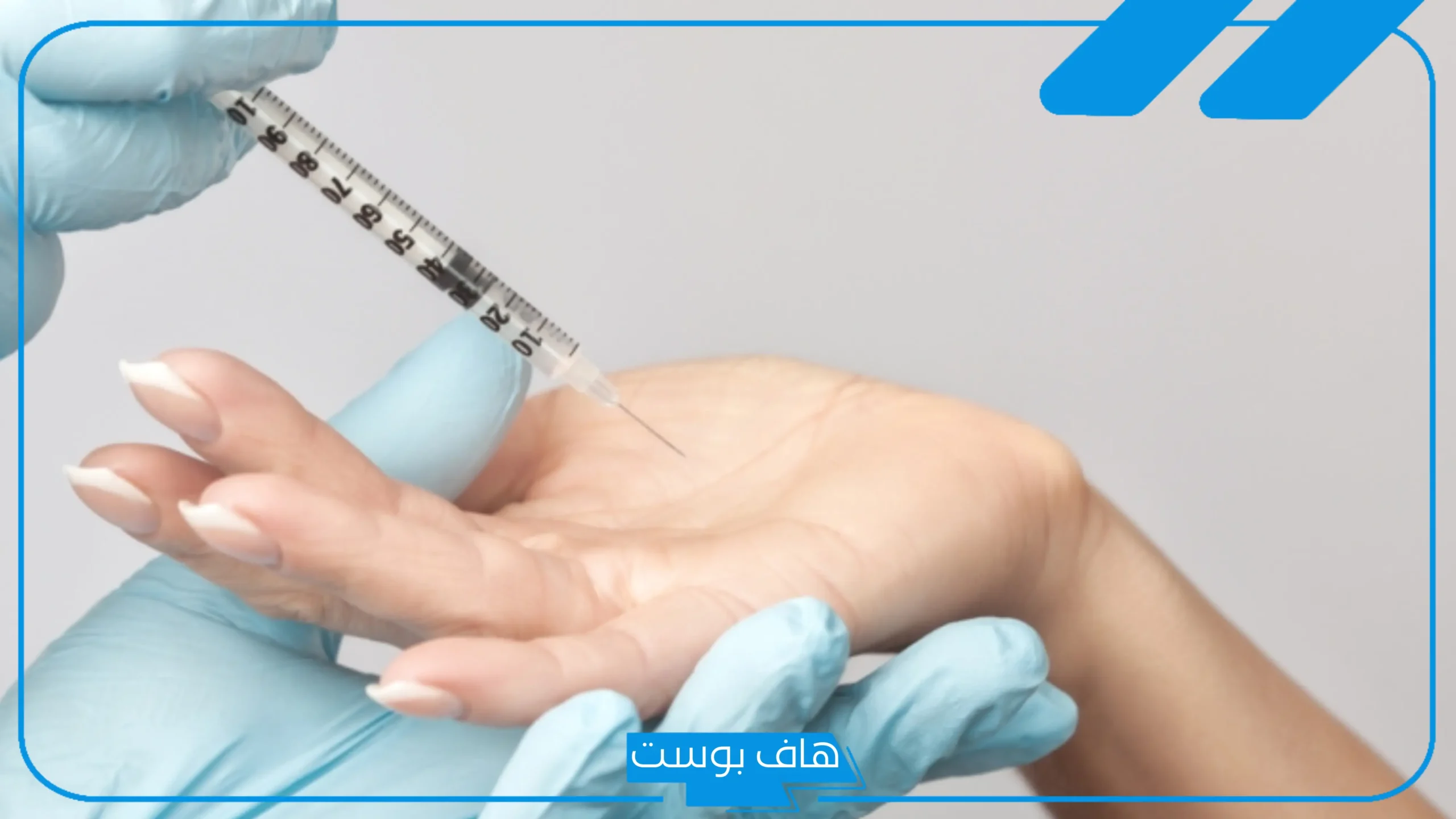 تجربتي مع ابر التعرق قبل وبعد وأهم التعليمات.. هل بوتكس التعرق يمنع الرائحة؟