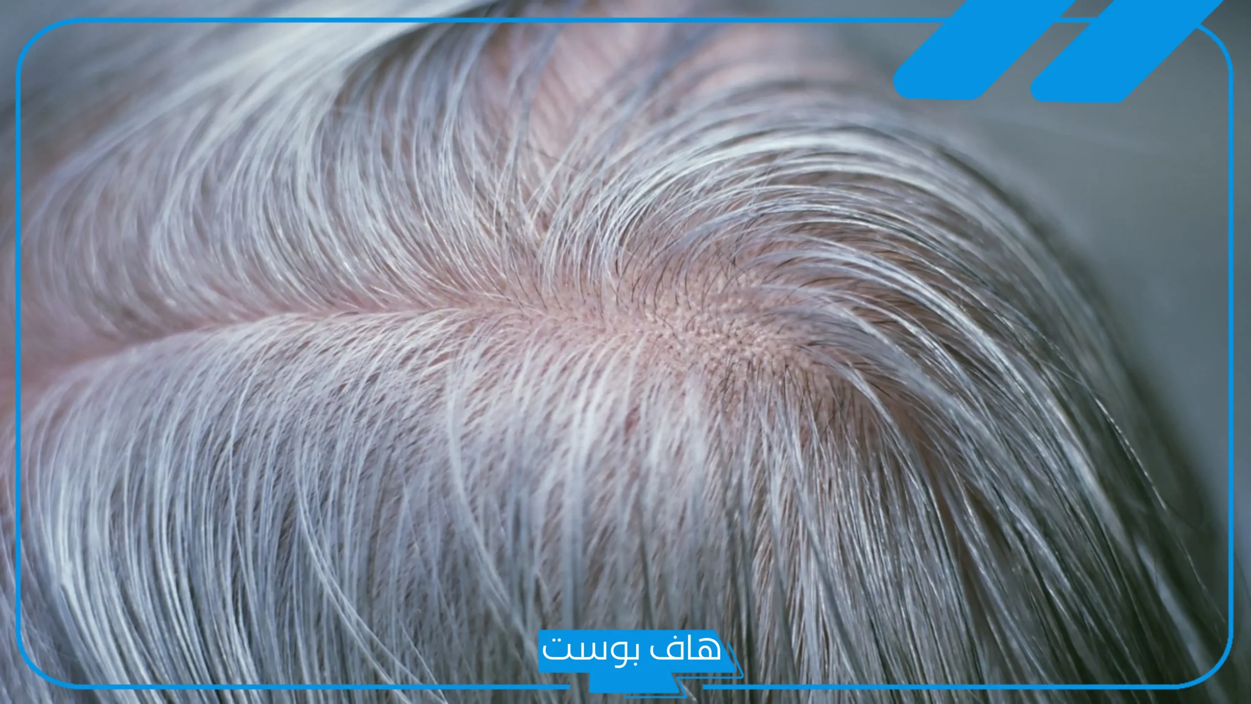 تجربتي مع الوسمه لعلاج الشيب، هل لها آثار جانبية؟