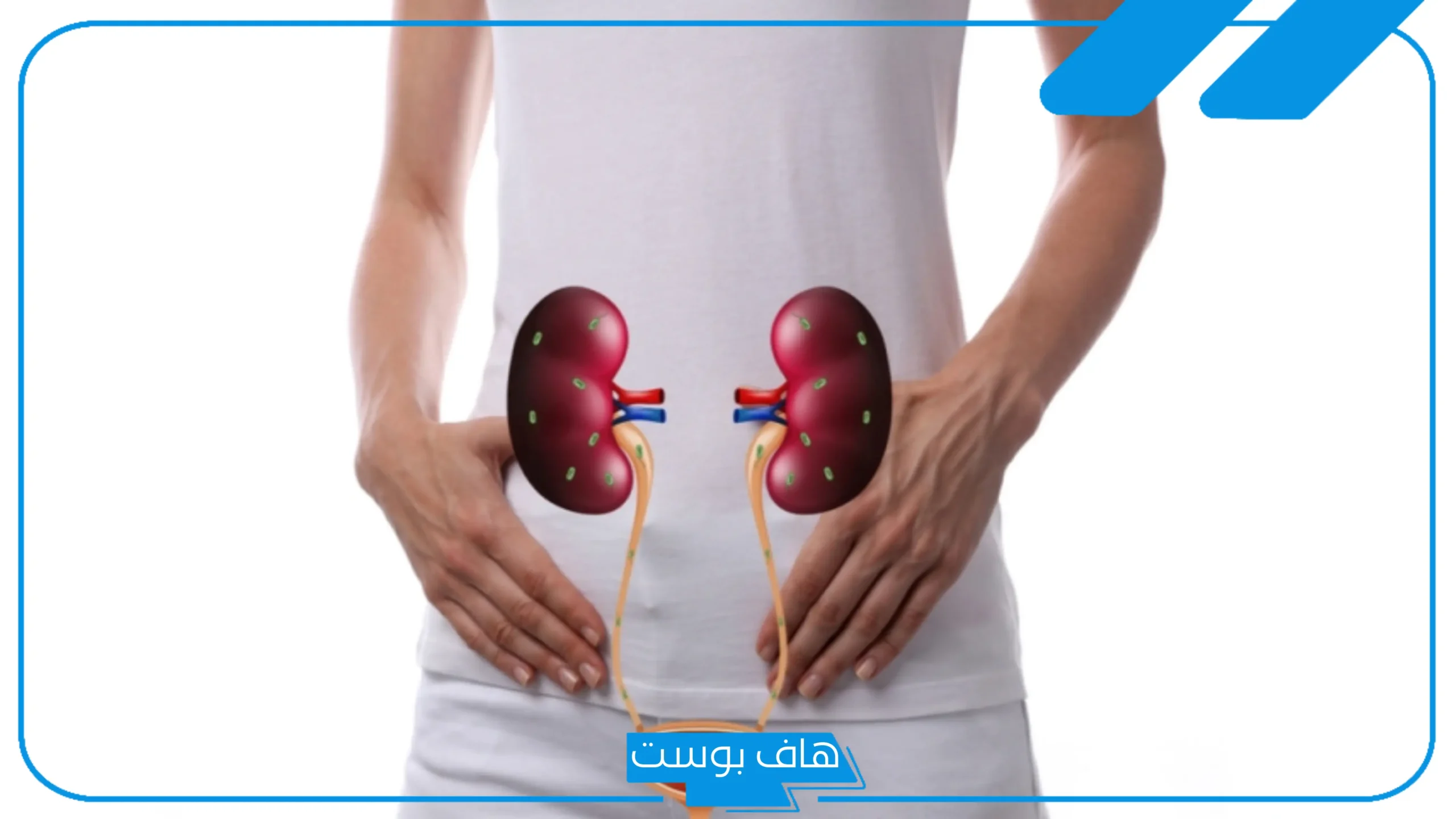 علاج التهاب البول تجربتي كاملة في المنزل