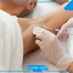 تجربتي مع ابر التعرق قبل وبعد وأهم التعليمات.. هل بوتكس التعرق يمنع الرائحة؟