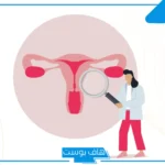 تجربتي مع التشنج المهبلي.. كيف أعرف أنني مصابة بالتشنج المهبلي؟