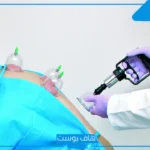 تجربتي مع الحجامة للعين.. فوائد الحجامة للعين والحسد