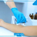 تجربتي مع الفصد لعلاج آلام المفاصل.. ماذا يعالج الفصد؟