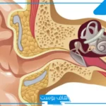 تجربتي مع انسداد قناة استاكيوس والمدة.. أعراض انسداد قناة استاكيوس المزمن