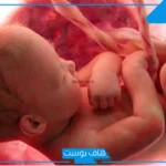 تجربتي مع زيادة الماء حول الجنين كاملة بالأعراض والعلامات