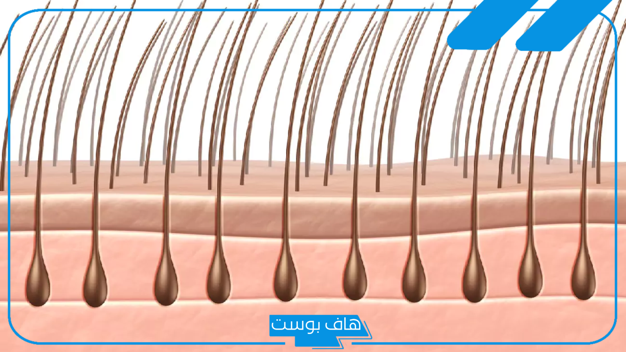 تجربتي مع التهاب بصيلات الشعر وطرق العلاجية المنزلية.. أنواع التهاب بصيلات الشعر 