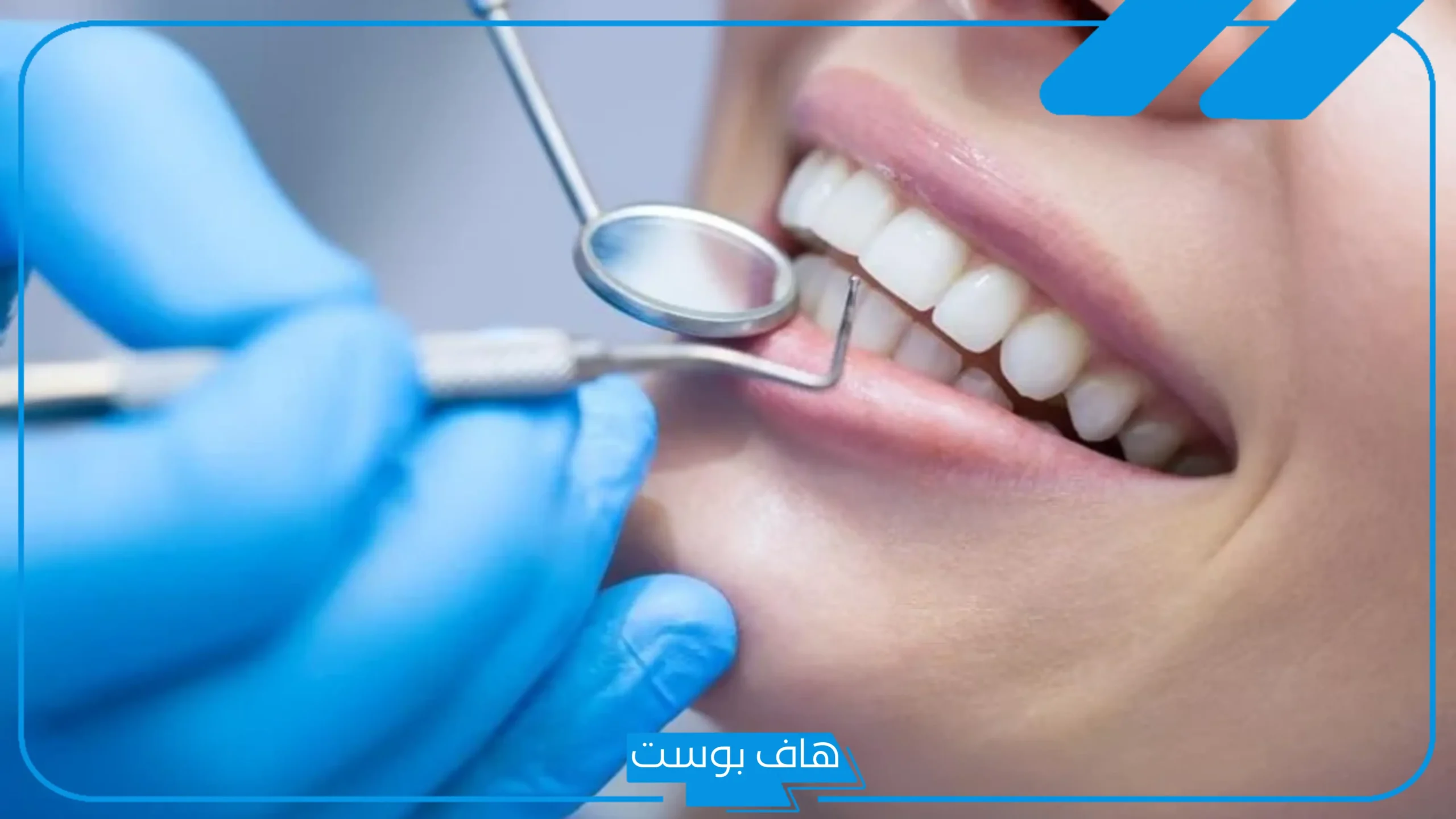 تفسير حلم تنظيف الاسنان في المنام عند الطبيب للرجل لابن سيرين
