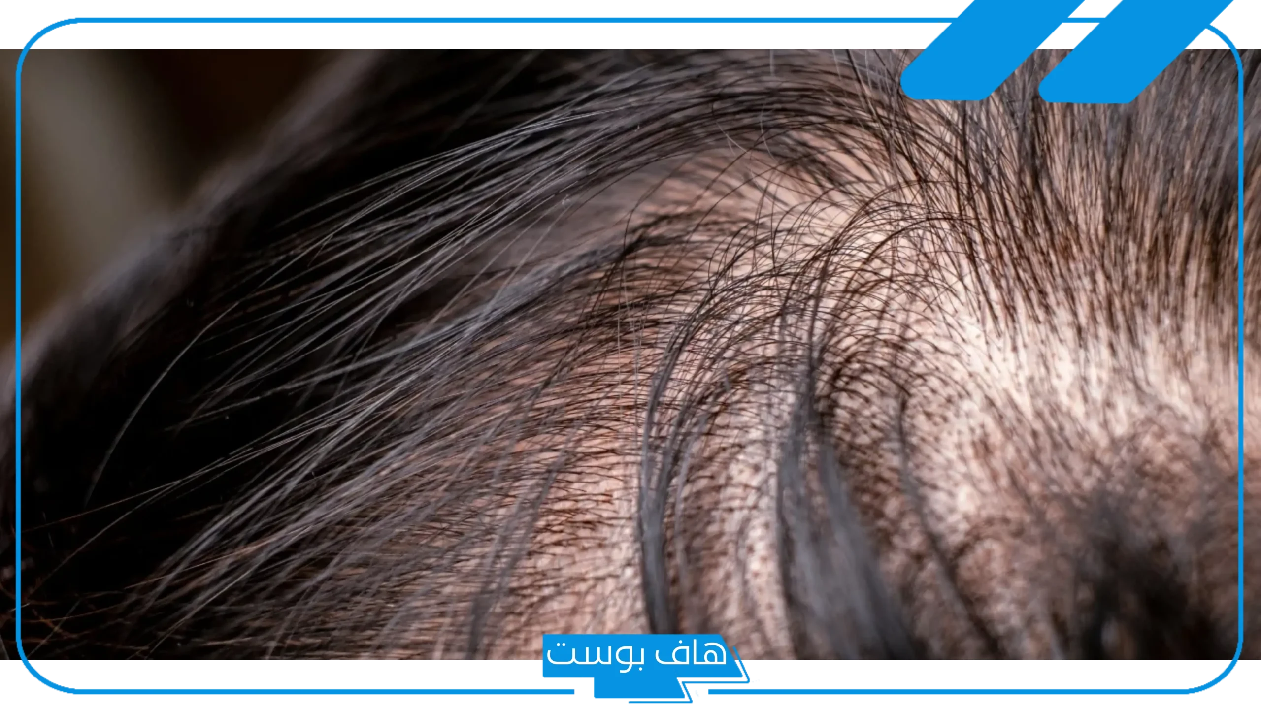 تفسير حلم القمل في الشعر وقتله للمتزوجه والحامل والعزباء في المنام