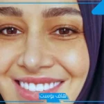 حلا شيحة تعود للحجاب مجددًا وتثير الجدل حول مستقبلها الفني