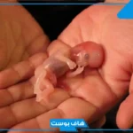 حلمت اني اجهضت وانا لست حامل في المنام لكبار العلماء
