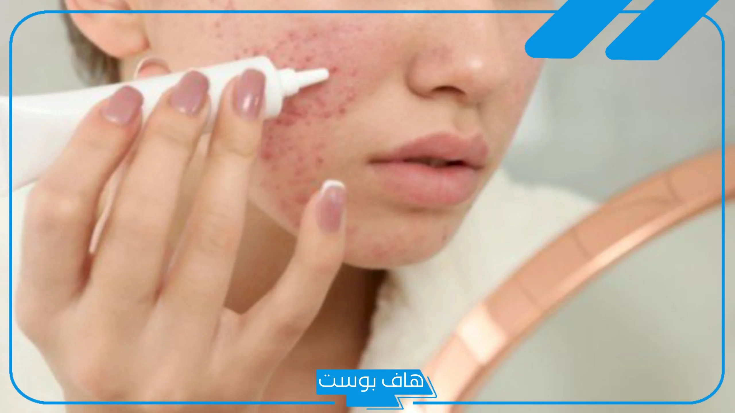 تجربتي مع هاي كوين للمنطقه الحساسة للتفتيح والنتيجة