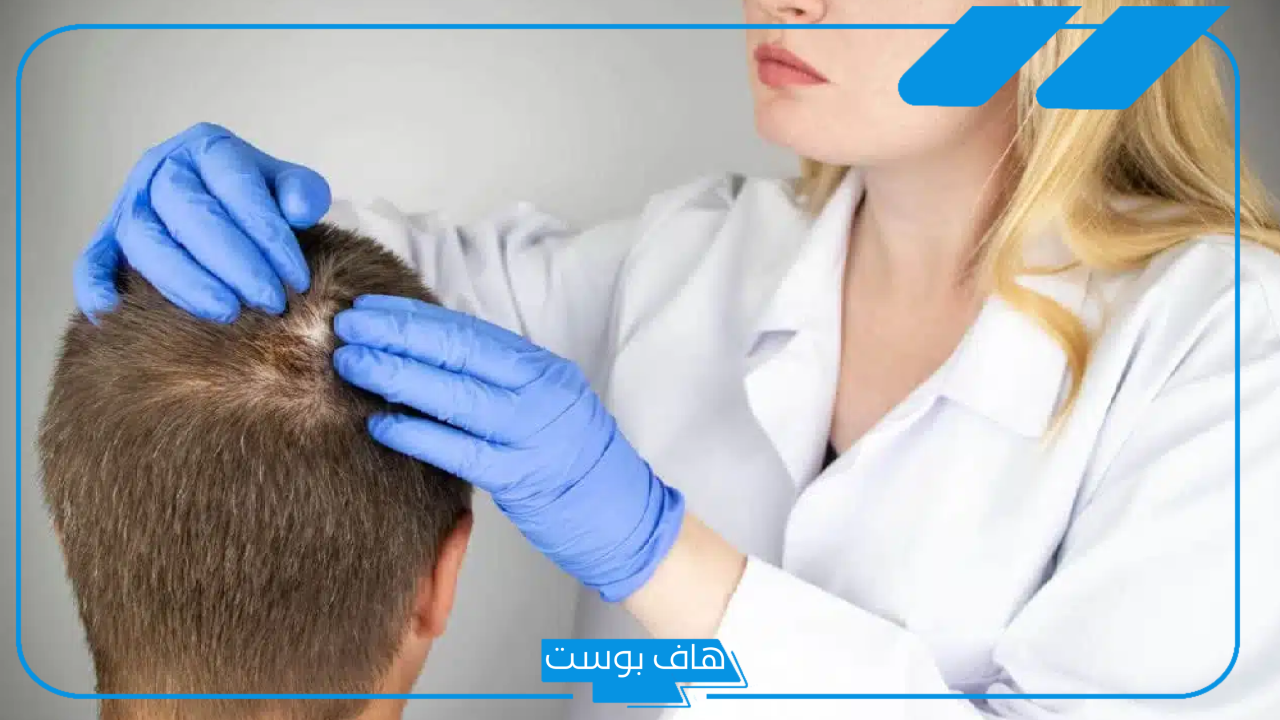 تجربتي مع حقن البلازما للشعر والنتيجة.. نصائح قبل حقن البلازما للشعر