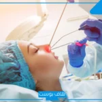 تجربتي مع عملية الجيوب الأنفية بالفوائد وما بعدها