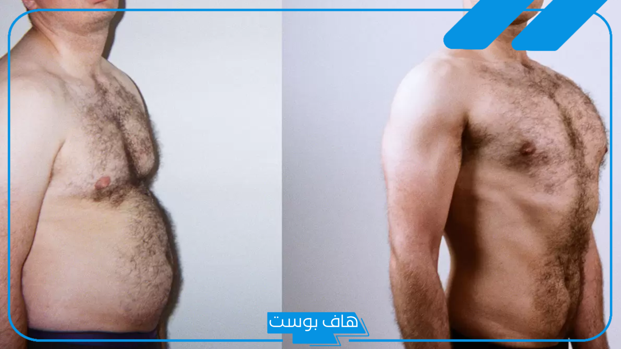 تجربتي مع عملية شفط الدهون ونصائح للحفاظ على الجسم بعد شفط الدهون