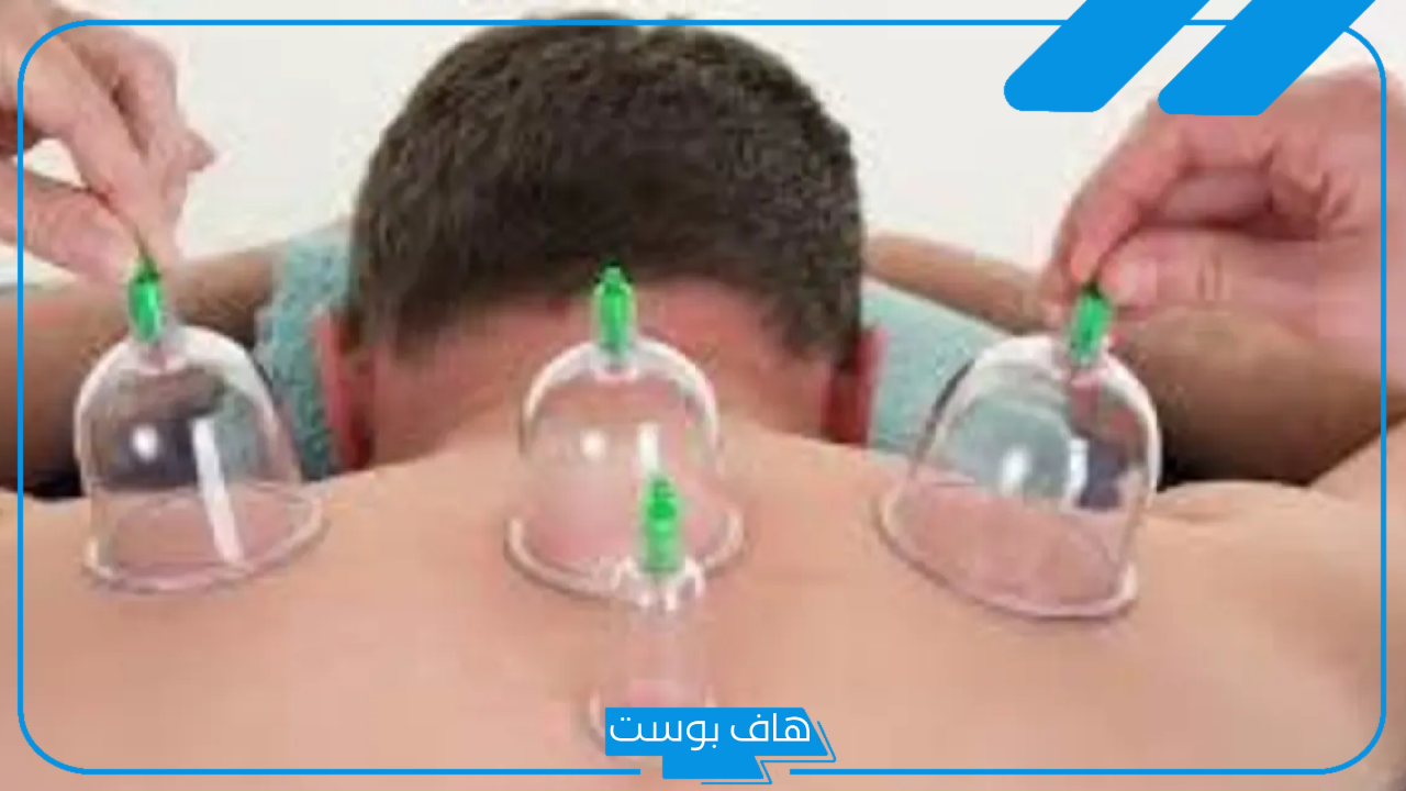 تجربتي مع الحجامة للعين.. فوائد الحجامة للعين والحسد