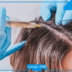 تجربتي مع فيلر الشعر.. أضرار فيلر الشعر وطريقة الاستخدام