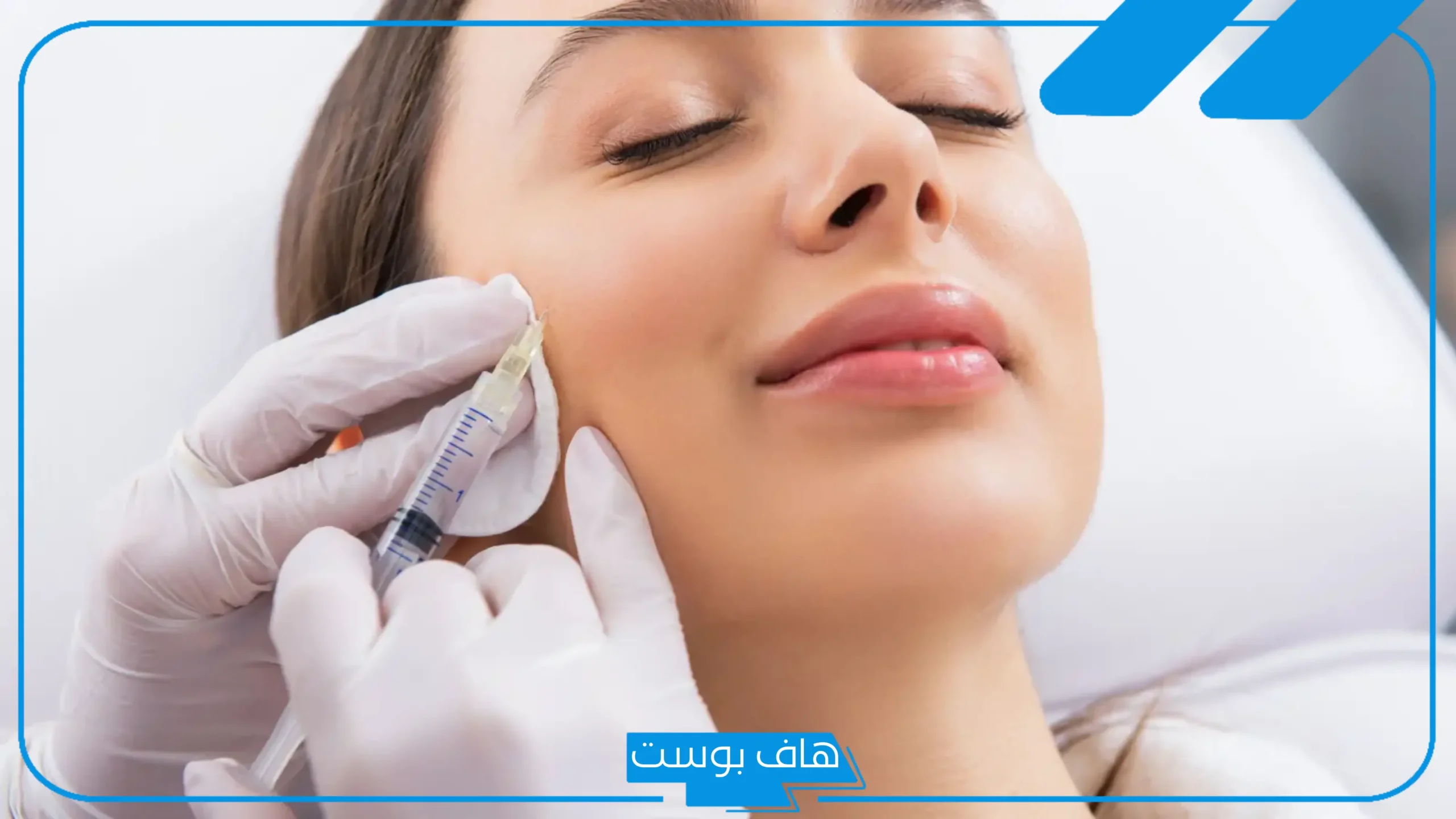 تجربتي مع فيلر الخدود قبل وبعد والأضرار الناجمة عنه