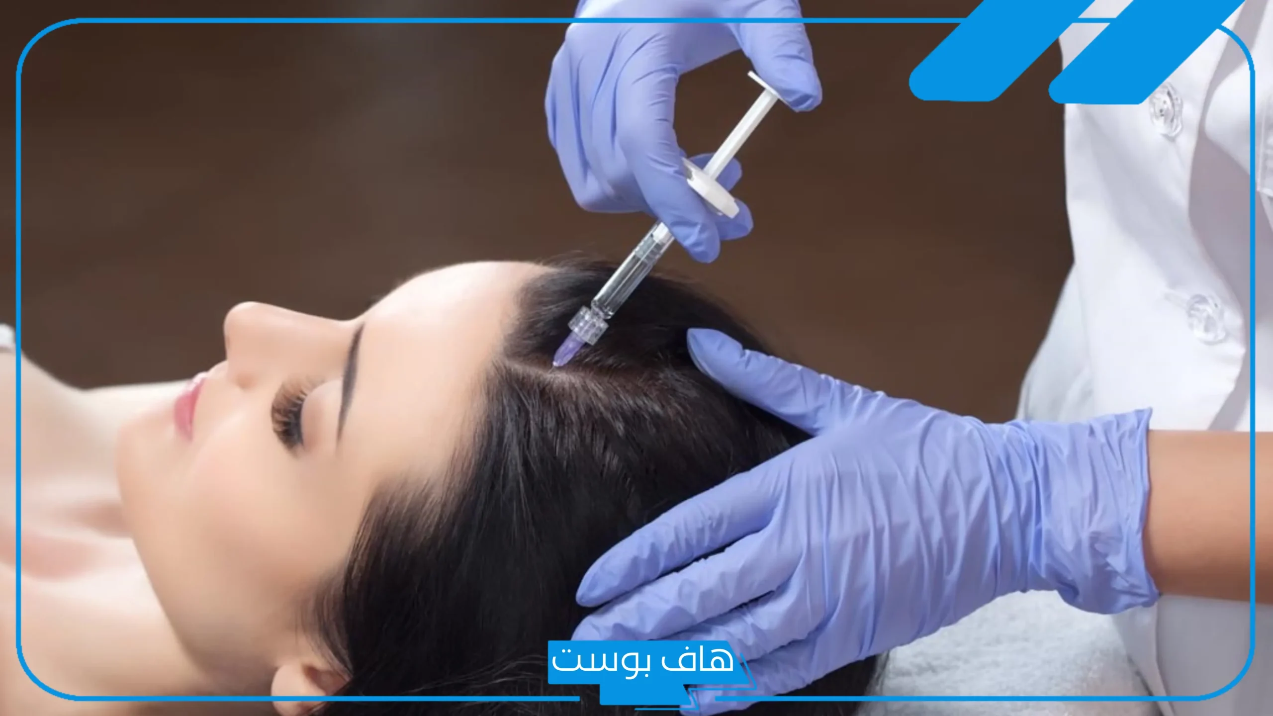 تجربتي مع فيلر الشعر.. أضرار فيلر الشعر وطريقة الاستخدام