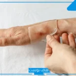تجربتي مع لصقات السيليكون للحروق.. أفضل أنواع لصقات السيليكون