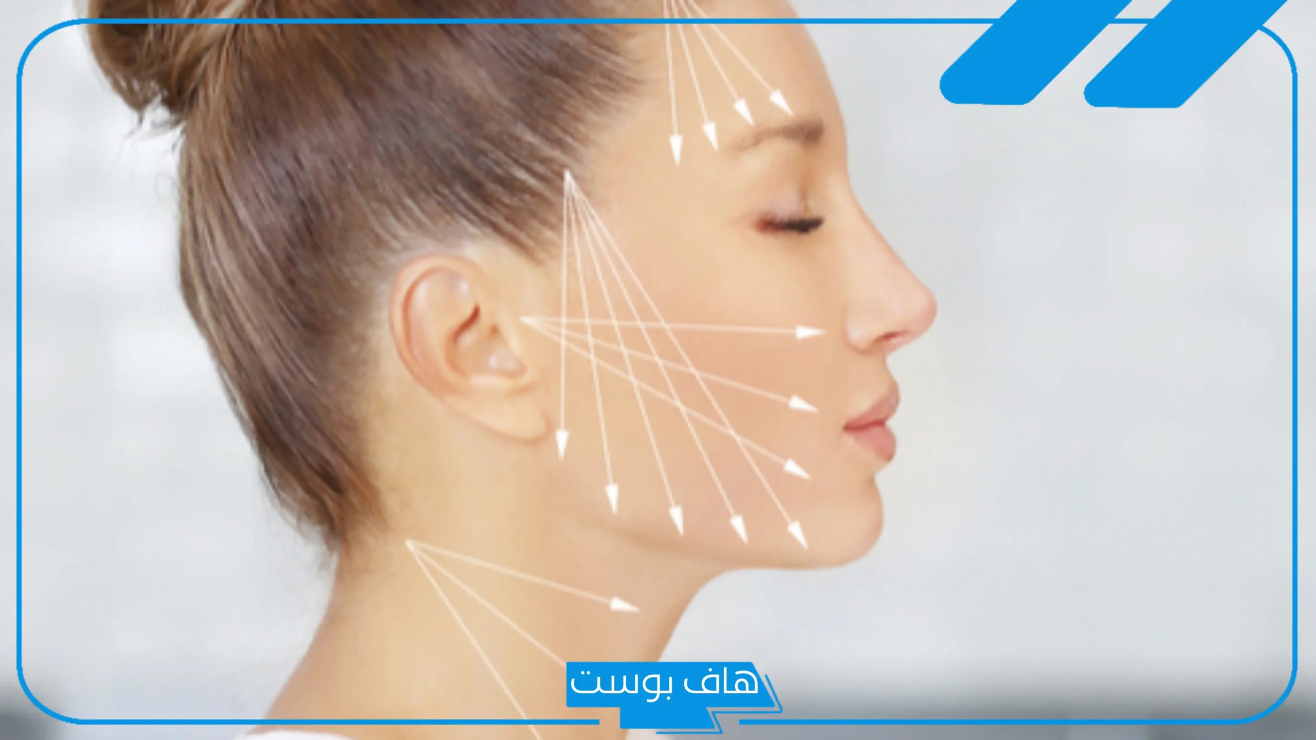تجربتي مع خيوط شد الوجه.. متى يبدأ مفعول خيوط شد الوجه؟