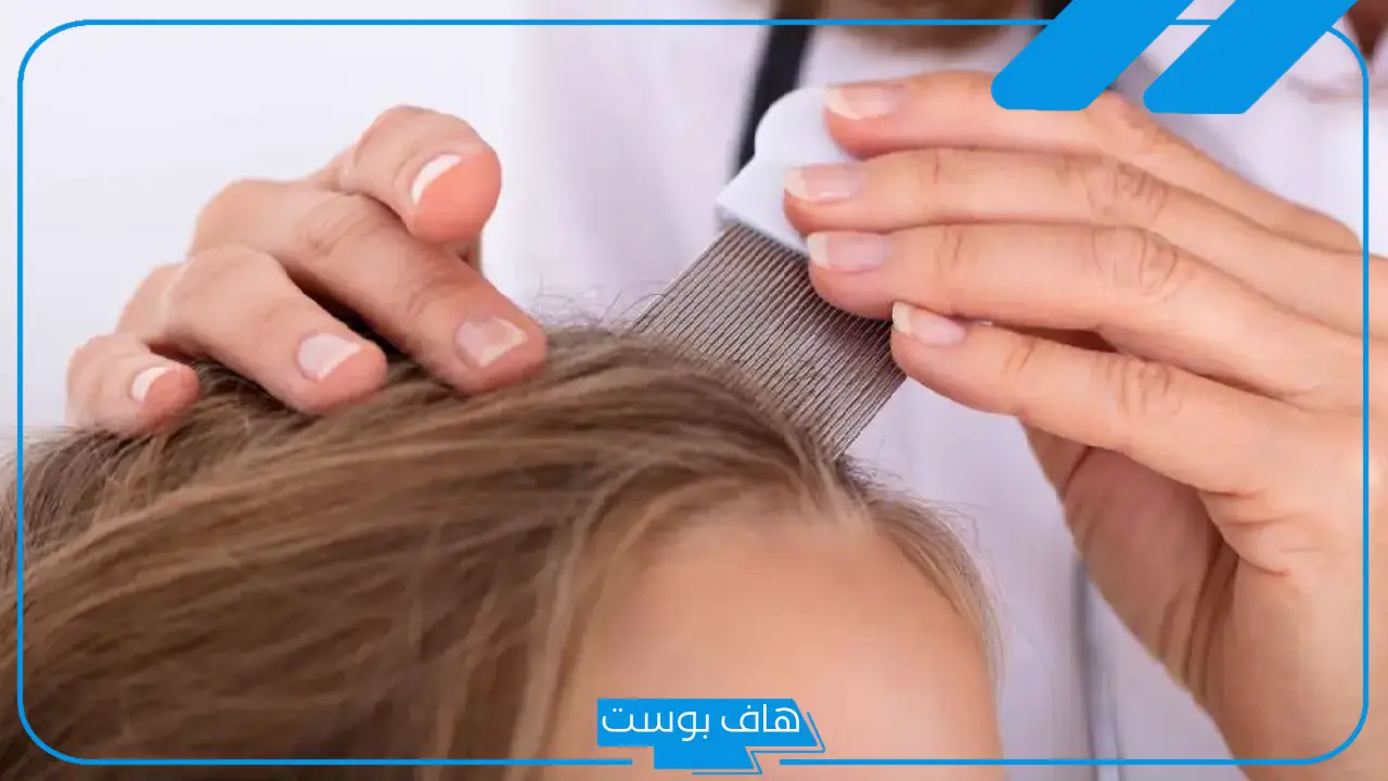 تفسير حلم القمل في الشعر للمرأة العزباء ولشخص آخر لابن سيرين في المنام