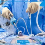 تجربتي مع منظار الرحم ونسبة النجاح.. مين عملت منظار للرحم وحملت؟