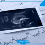 تجربتي مع توقف نبض الجنين في الشهر الثالث ورجوعه