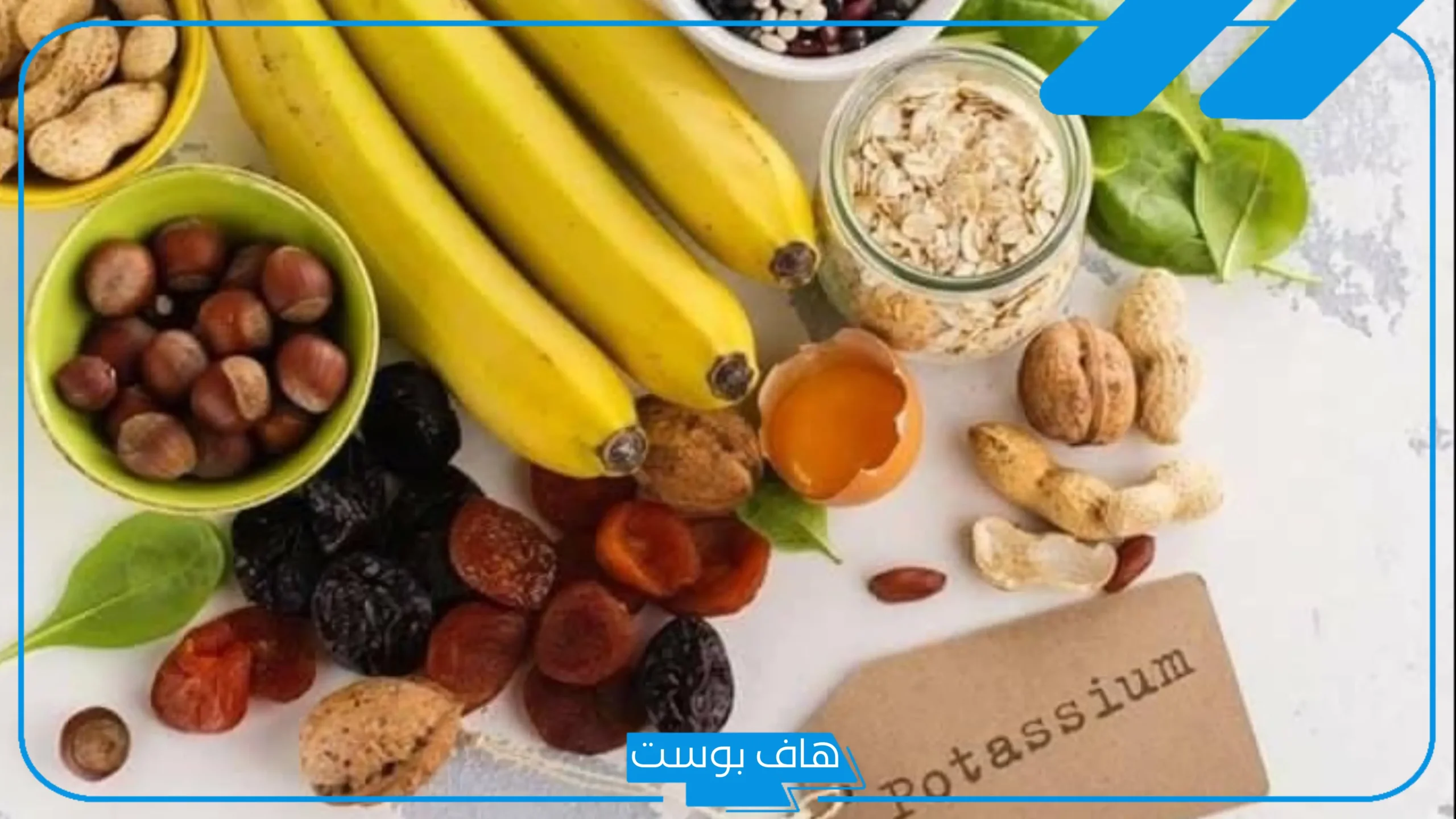 تجربتي مع نقص البوتاسيوم عالم حواء.. أعراض نقص البوتاسيوم النفسية