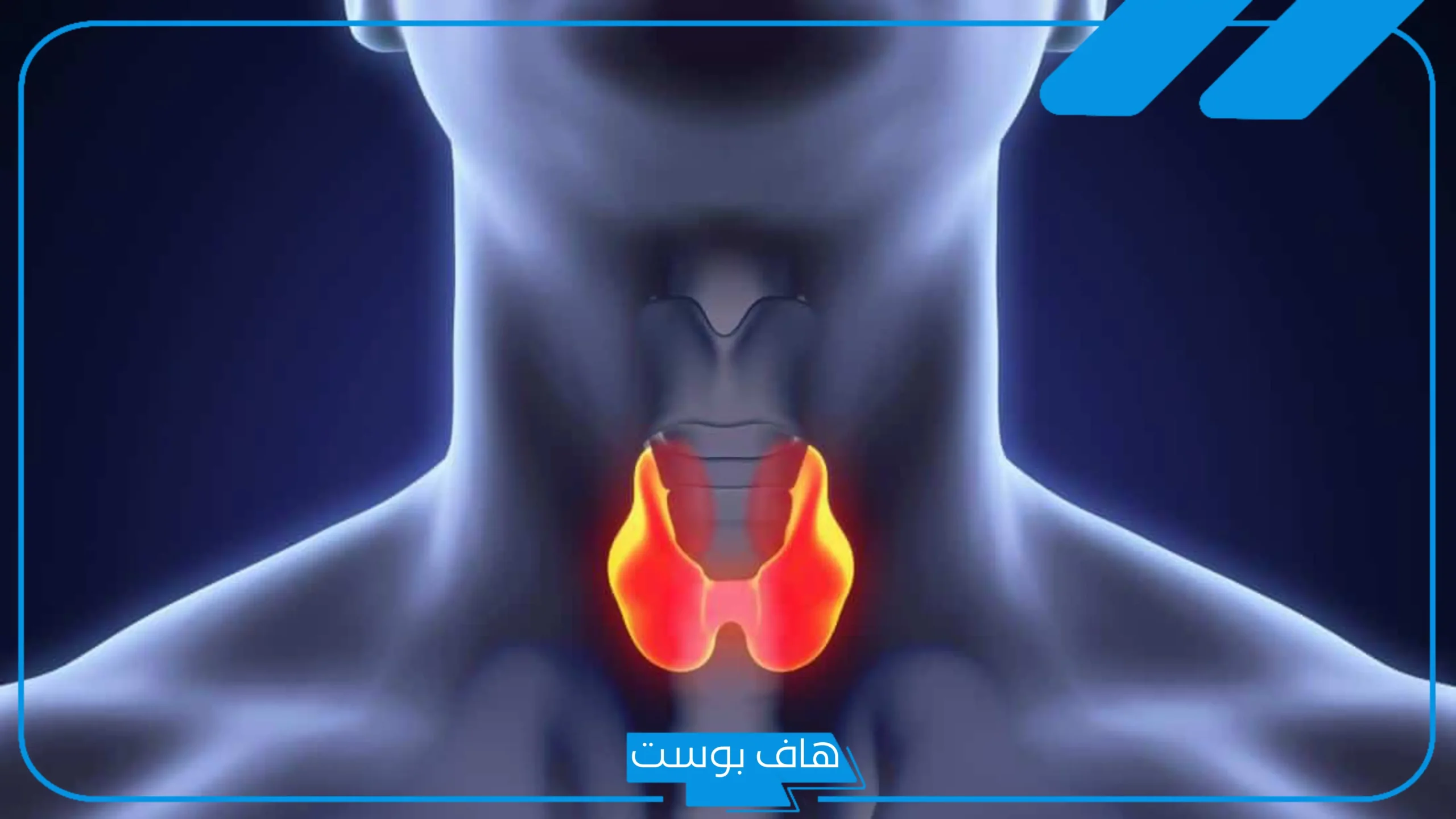 تجربتي مع عقد الغدة الدرقية.. مين عندها عقد في الغدة الدرقية عالم حواء؟