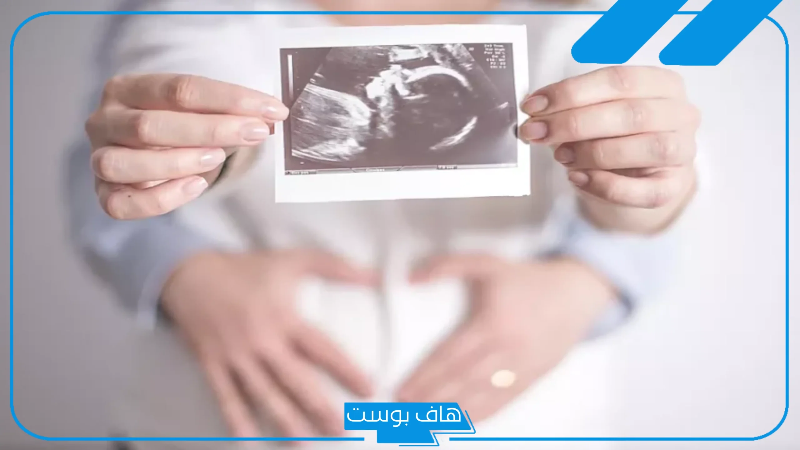 تجربتي مع توقف نبض الجنين في الشهر الثالث ورجوعه
