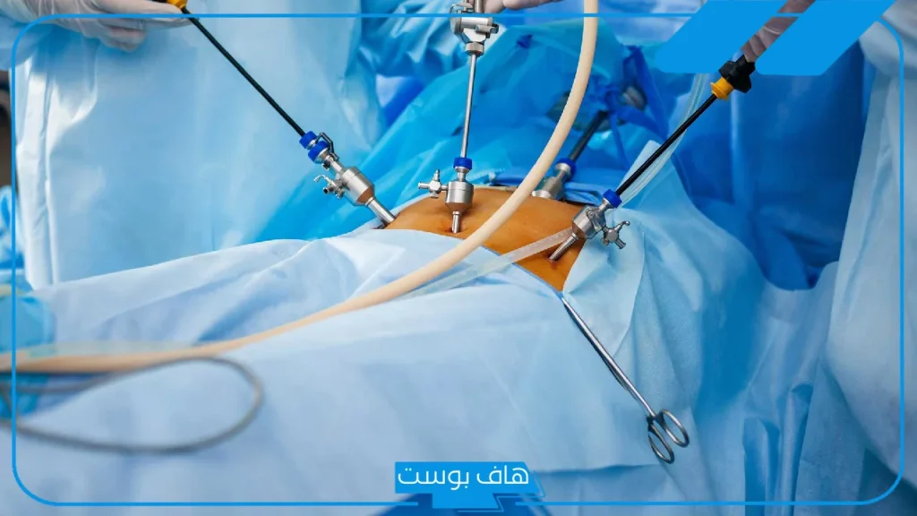 تفسير حلم عملية جراحية في البطن للمرأة في المنام لابن سيرين