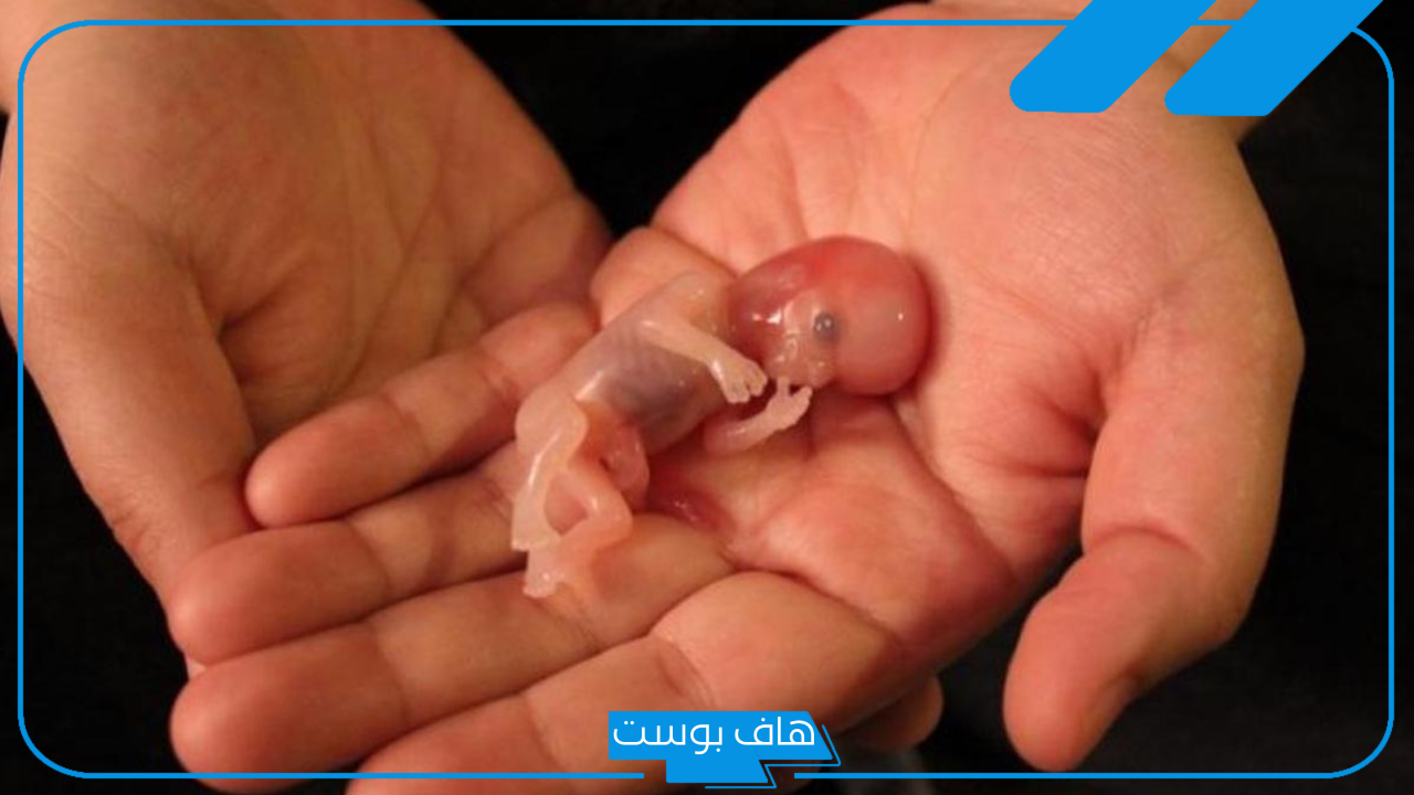 تفسير حلم الاجهاض في المنام وموت الجنين للحامل وغير الحامل لابن سيرين