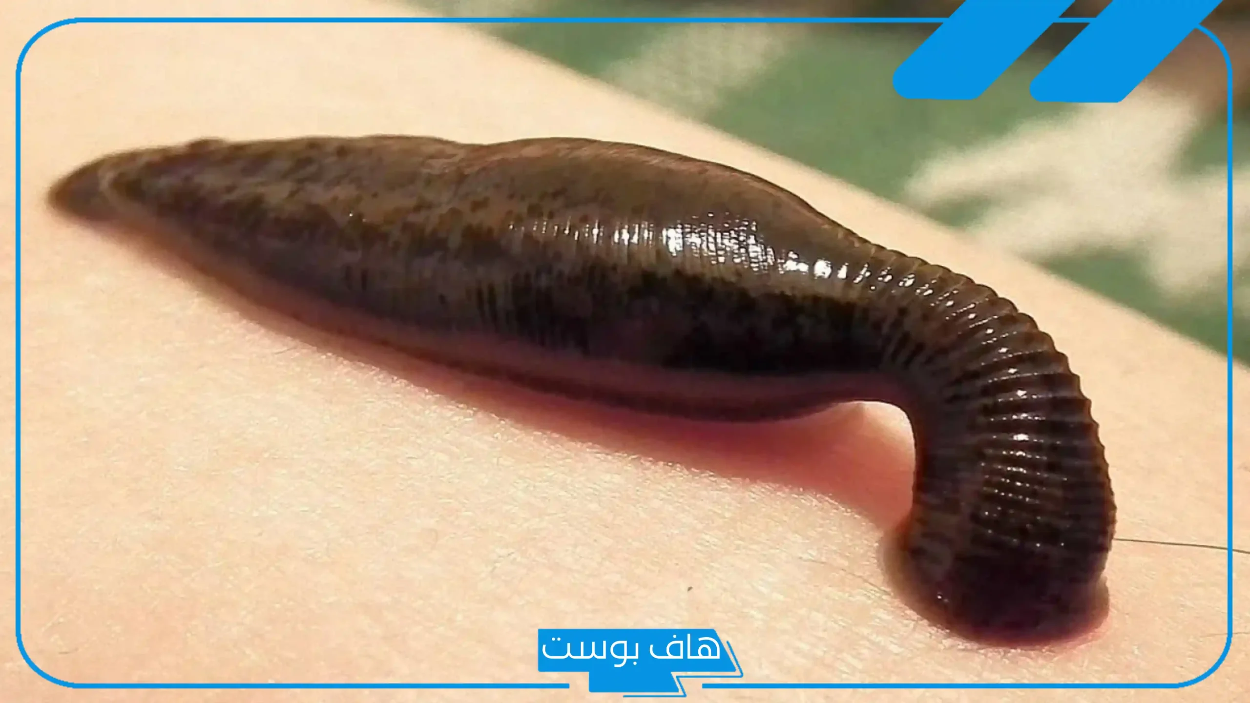 تفسير حلم الدود يمشي على الجسم في المنام للرجل والمرأة لابن سيرين