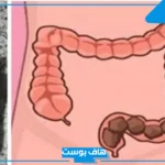 تفسير حلم قضاء الحاجة البراز في المنام للرجل والمرأة وتنظيفه لابن سيرين