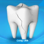 تفسير حلم كسر الضرس في المنام وسقوطه للرجل والمرأة المتزوجة