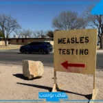 تفشٍ مثير للقلق.. الحصبة تهاجم مجددًا في تكساس وسط تحذيرات صحية