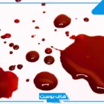 تفسير حلم استفراغ الدم في المنام للمتزوجة والعزباء والمسحور لابن سيرين