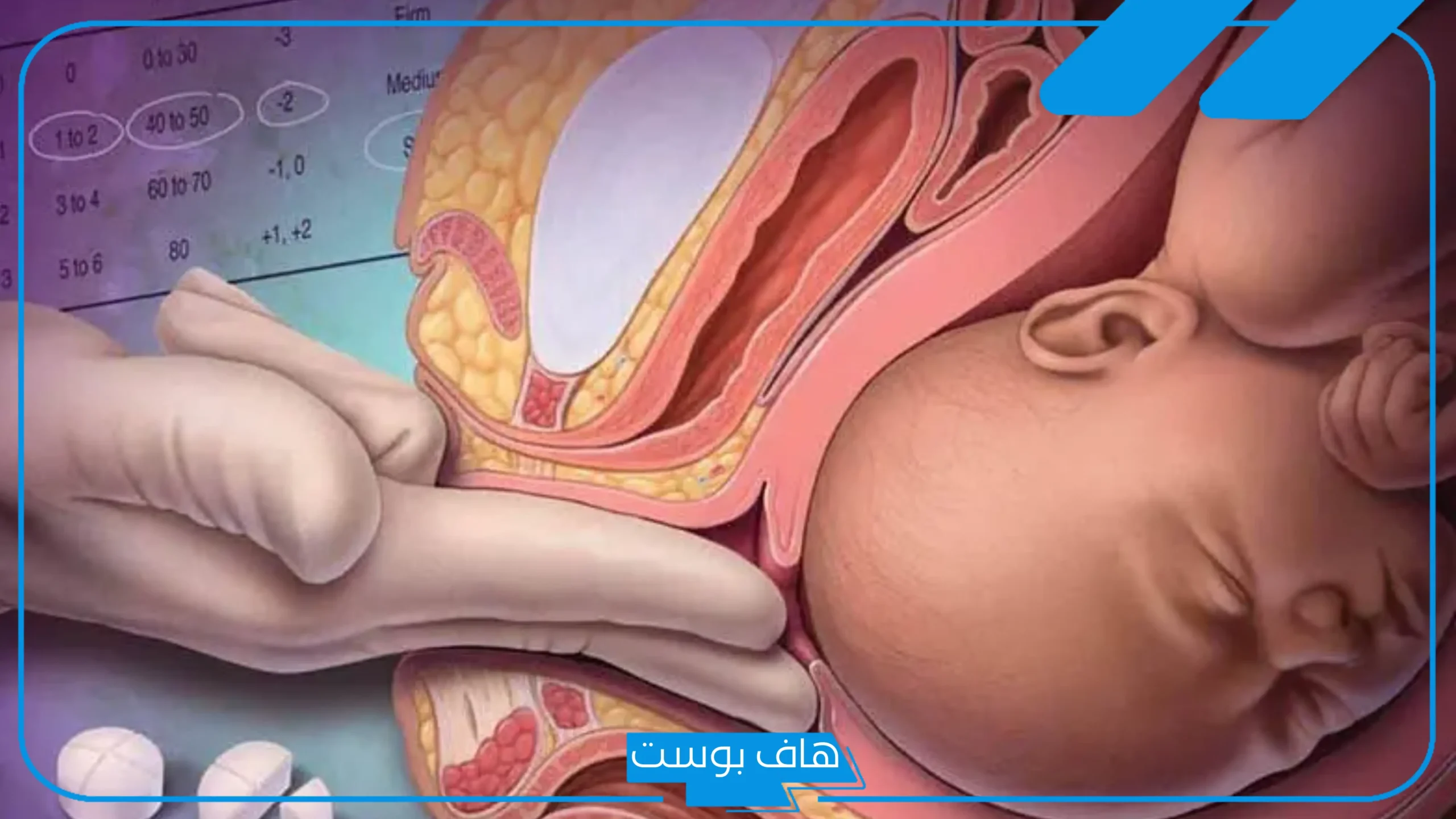 كيف اسوي تحريض لنفسي باليد والرحم مسكر؟ مين سوت تحريض وولدت بنفس اليوم